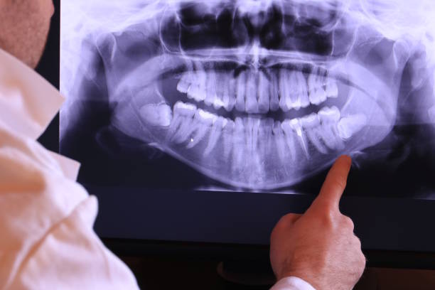 Best Tooth Infection Emergency Dentist  in Port St Joe, FL