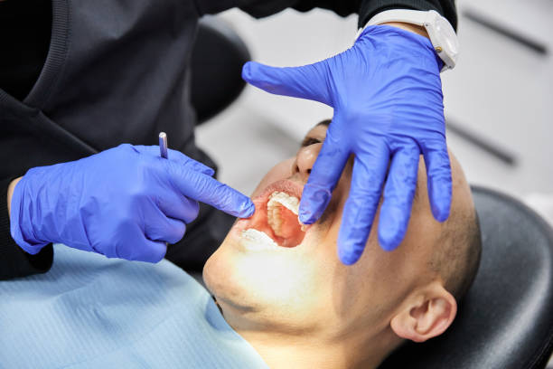 Best Root Canal Emergency Dentist  in Port St Joe, FL