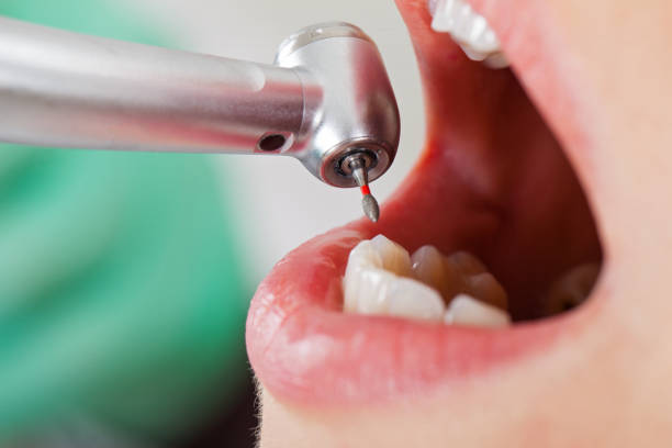 Best Urgent Tooth Repair  in Port St Joe, FL